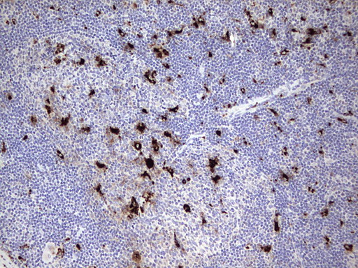 Nor-1 / NR4A3 Antibody - Immunohistochemical staining of paraffin-embedded Human lymph node tissue within the normal limits using anti-NR4A3 mouse monoclonal antibody. (Heat-induced epitope retrieval by 1 mM EDTA in 10mM Tris, pH8.5, 120C for 3min,