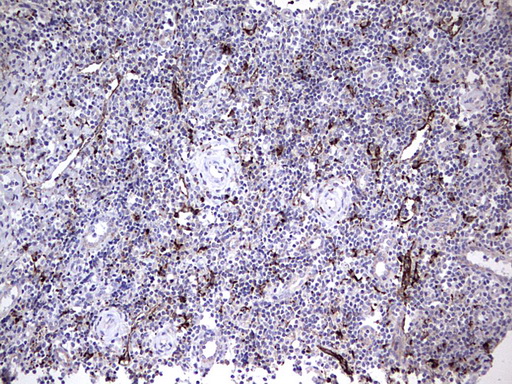 Nor-1 / NR4A3 Antibody - IHC of paraffin-embedded Human tonsil using anti-NR4A3 mouse monoclonal antibody. (Heat-induced epitope retrieval by 1 mM EDTA in 10mM Tris, pH8.5, 120°C for 3min).