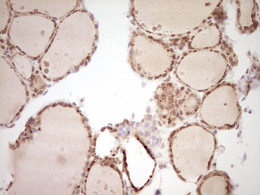 Nor-1 / NR4A3 Antibody - Immunohistochemical staining of paraffin-embedded Human thyroid tissue within the normal limits using anti-NR4A3 mouse monoclonal antibody. (Heat-induced epitope retrieval by Tris-EDTA, pH8.0) Dilution: 1:150
