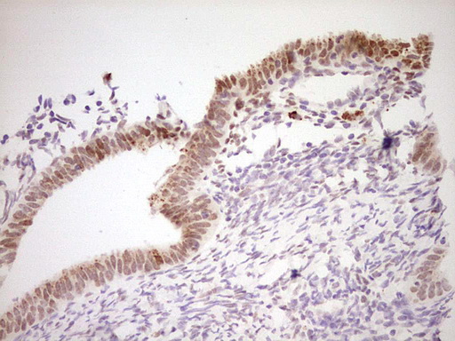 Nor-1 / NR4A3 Antibody - Immunohistochemical staining of paraffin-embedded Human endometrium tissue within the normal limits using anti-NR4A3 mouse monoclonal antibody. (Heat-induced epitope retrieval by Tris-EDTA, pH8.0) Dilution: 1:150