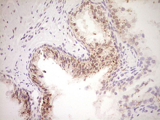 Nor-1 / NR4A3 Antibody - Immunohistochemical staining of paraffin-embedded Human prostate tissue within the normal limits using anti-NR4A3 mouse monoclonal antibody. (Heat-induced epitope retrieval by Tris-EDTA, pH8.0) Dilution: 1:150