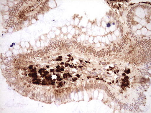 Nor-1 / NR4A3 Antibody - Immunohistochemical staining of paraffin-embedded Human colon tissue within the normal limits using anti-NR4A3 Mouse monoclonal antibody. (Heat-induced epitope retrieval by Tris-EDTA, pH8.0) Dilution: 1:150