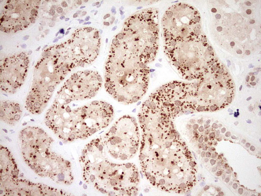 Nor-1 / NR4A3 Antibody - Immunohistochemical staining of paraffin-embedded Human Kidney tissue within the normal limits using anti-NR4A3 mouse monoclonal antibody. (Heat-induced epitope retrieval by Tris-EDTA, pH8.0) Dilution: 1:150
