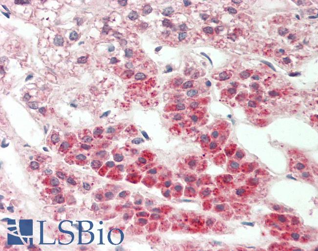 Nor-1 / NR4A3 Antibody - Human Adrenal: Formalin-Fixed, Paraffin-Embedded (FFPE).  This image was taken for the unconjugated form of this product. Other forms have not been tested.