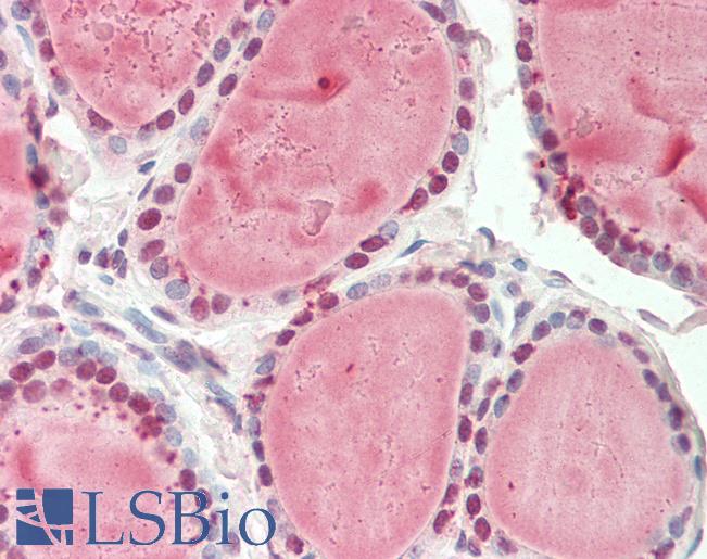 Nor-1 / NR4A3 Antibody - Human Thyroid: Formalin-Fixed, Paraffin-Embedded (FFPE).  This image was taken for the unconjugated form of this product. Other forms have not been tested.