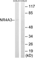 Nor-1 / NR4A3 Antibody - Western blot analysis of lysates from COLO cells, using NR4A3 Antibody. The lane on the right is blocked with the synthesized peptide.
