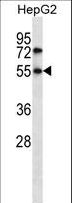 Nor-1 / NR4A3 Antibody - NR4A3 Antibody western blot of HepG2 cell line lysates (35 ug/lane). The NR4A3 antibody detected the NR4A3 protein (arrow).