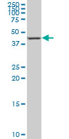 Nor-1 / NR4A3 Antibody - NR4A3 monoclonal antibody (M02), clone 1E9 Western Blot analysis of NR4A3 expression in HeLa NE.