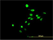 Nor-1 / NR4A3 Antibody - Immunofluorescence of monoclonal antibody to NR4A3 on HeLa cell. [antibody concentration 10 ug/ml]