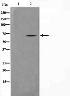 Nor-1 / NR4A3 Antibody - Western blot analysis on COLO205 cell lysates using NR4A3 antibody. The lane on the left is treated with the antigen-specific peptide.