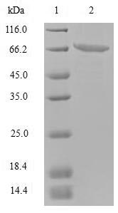 Capsid Protein VP1 Protein - (Tris-Glycine gel) Discontinuous SDS-PAGE (reduced) with 5% enrichment gel and 15% separation gel.