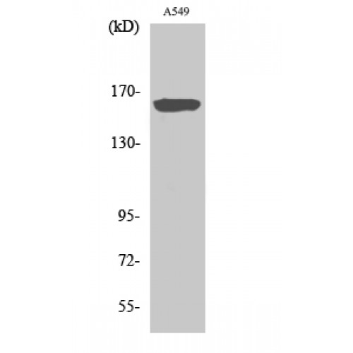 NOS1 / nNOS Antibody - Western blot of NOS1 antibody