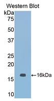 NOS1 / nNOS Antibody - Western blot of NOS1 / nNOS antibody.