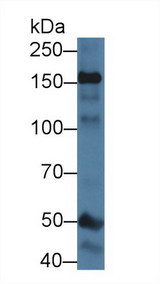 NOS1 / nNOS Antibody - Western Blot; Sample: Mouse Cerebrum lysate; Primary Ab: 1µg/ml Rabbit Anti-Mouse NOS1 Antibody Second Ab: 0.2µg/mL HRP-Linked Caprine Anti-Rabbit IgG Polyclonal Antibody