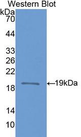 NOS1 / nNOS Antibody - Western Blot; Sample: Recombinant protein.