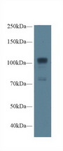 NOS1 / nNOS Antibody - Western Blot; Sample: Human A549 cell lysate; Primary Ab: 1µg/ml Rabbit Anti-Rat NOS1 Antibody Second Ab: 0.2µg/mL HRP-Linked Caprine Anti-Rabbit IgG Polyclonal Antibody