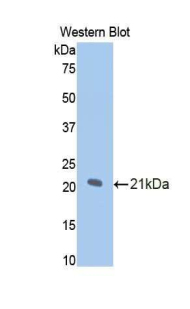 NOS1 / nNOS Antibody - Western blot of recombinant NOS1 / nNOS.  This image was taken for the unconjugated form of this product. Other forms have not been tested.