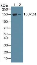 NOS1 / nNOS Antibody - Western Blot; Sample: Lane1: Mouse Brain Tissue; Lane2: Mouse Cerebellum Tissue.