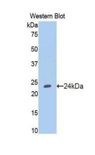 NOS1 / nNOS Antibody - Western blot of recombinant NOS1 / nNOS.  This image was taken for the unconjugated form of this product. Other forms have not been tested.