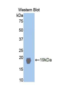 NOS1 / nNOS Antibody - Western blot of recombinant NOS1 / nNOS.  This image was taken for the unconjugated form of this product. Other forms have not been tested.