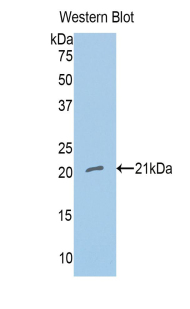 NOS1 / nNOS Antibody - Western blot of recombinant NOS1 / nNOS.  This image was taken for the unconjugated form of this product. Other forms have not been tested.