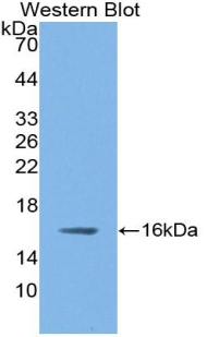 NOS1 / nNOS Antibody - Western Blot; Sample: Recombinant protein.