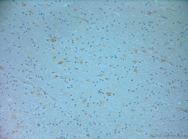 NOS1 / nNOS Antibody - Goat antibody to NOS1. IHC on paraffin sections of human brain tissue using Goat antibody to NOS1. HIER: 1 mM EDTA, pH 8 for 20 min using Thermo PT Module. Blocking: 0.2% LFDM in TBST filtered through a 0.2 micron filter. Detection was done using Novolink HRP polymer from Leica following manufacturer's instructions. Primary antibody: dilution 1:100, incubated 30 min at RT (using Autostainer). Sections were counterstained with Harris Hematoxylin.