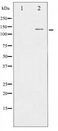 NOS1 / nNOS Antibody - Western blot of nNOS expression in INF treated RAW264.7 whole cell lysates,The lane on the left is treated with the antigen-specific peptide.