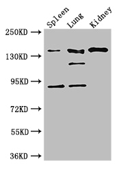 NOS1 / nNOS Antibody - Positive WB detected in:Mouse spleen tissue,Mouse lung tissue,Mouse kidney tissue;All lanes: NOS1 antibody at 3ug/ml;Secondary;Goat polyclonal to rabbit IgG at 1/50000 dilution;Predicted band size: 161,149,126,44,165 kDa;Observed band size: 161,126,92 kDa;