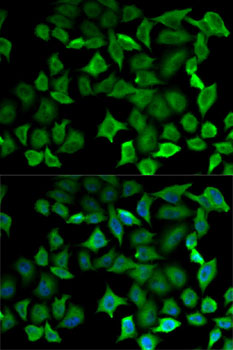 NOS1 / nNOS Antibody - Immunofluorescence analysis of HeLa cells using NOS1 antibody. Blue: DAPI for nuclear staining.