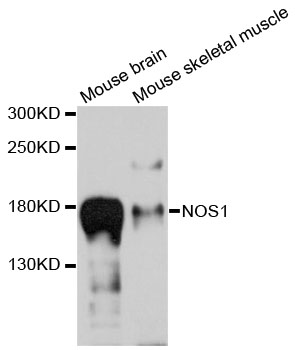 NOS1 / nNOS Antibody - Western blot analysis of extracts of various cell lines, using NOS1 antibody at 1:1000 dilution. The secondary antibody used was an HRP Goat Anti-Rabbit IgG (H+L) at 1:10000 dilution. Lysates were loaded 25ug per lane and 3% nonfat dry milk in TBST was used for blocking. An ECL Kit was used for detection and the exposure time was 5s.