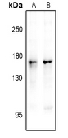 NOS1 / nNOS Antibody - Western blot analysis of nNOS (pS1417) expression in A549 (A), HEK293T (B) whole cell lysates.