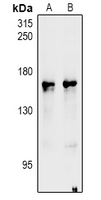 NOS1 / nNOS Antibody - Western blot analysis of nNOS expression in A549 (A), HEK293T (B) whole cell lysates.