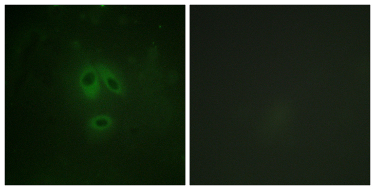 NOS1 / nNOS Antibody - Immunofluorescence analysis of HeLa cells, using n-NOS (Phospho-Ser852) Antibody. The picture on the right is blocked with the phospho peptide.