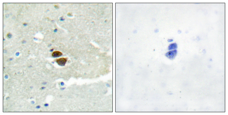 NOS1 / nNOS Antibody - Immunohistochemistry analysis of paraffin-embedded human brain, using n-NOS (Phospho-Ser852) Antibody. The picture on the right is blocked with the phospho peptide.