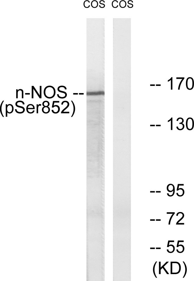 NOS1 / nNOS Antibody - Western blot analysis of lysates from A549 cells, using n-NOS (Phospho-Ser852) Antibody. The lane on the right is blocked with the phospho peptide.