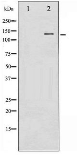 NOS1 / nNOS Antibody - Western blot of n-NOS phosphorylation expression in A549 whole cell lysates,The lane on the left is treated with the antigen-specific peptide.