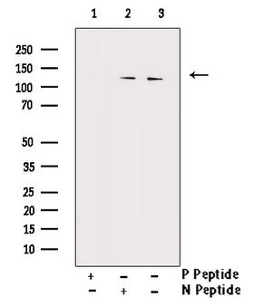 NOS1 / nNOS Antibody - Western blot analysis of Phospho-n-NOS (Ser852) antibody expression in A549 cells lysates. The lane on the right is treated with the antigen-specific peptide.