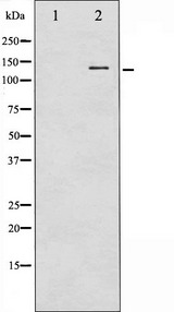NOS1 / nNOS Antibody - Western blot analysis of n-NOS phosphorylation expression in A549 whole cells lysates. The lane on the left is treated with the antigen-specific peptide.