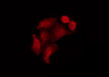 NOS1 / nNOS Antibody - Staining A549 cells by IF/ICC. The samples were fixed with PFA and permeabilized in 0.1% Triton X-100, then blocked in 10% serum for 45 min at 25°C. The primary antibody was diluted at 1:200 and incubated with the sample for 1 hour at 37°C. An Alexa Fluor 594 conjugated goat anti-rabbit IgG (H+L) Ab, diluted at 1/600, was used as the secondary antibody.