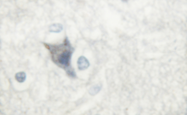 NOS1 / nNOS Antibody - 1/100 staining human brain tissue by IHC-P. The sample was formaldehyde fixed and a heat mediated antigen retrieval step in citrate buffer was performed. The sample was then blocked and incubated with the antibody for 1.5 hours at 22°C. An HRP conjugated goat anti-rabbit antibody was used as the secondary antibody.