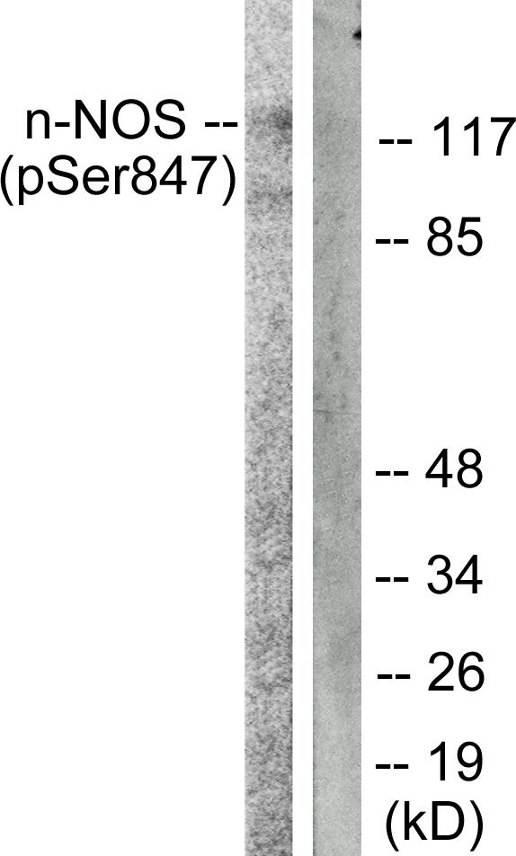 NOS1 / nNOS Antibody - Western blot analysis of extracts from A549 cells, using n-NOS (Phospho-Ser852) antibody.
