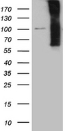 NOS1AP / CAPON Antibody - HEK293T cells were transfected with the pCMV6-ENTRY control. (Left lane) or pCMV6-ENTRY NOS1AP. (Right lane) cDNA for 48 hrs and lysed. Equivalent amounts of cell lysates. (5 ug per lane) were separated by SDS-PAGE and immunoblotted with anti-NOS1AP. (1:2000)