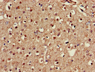NOS1AP / CAPON Antibody - Immunohistochemistry of paraffin-embedded human brain tissue at dilution of 1:100