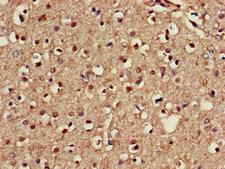 NOS1AP / CAPON Antibody - Immunohistochemistry of paraffin-embedded human brain tissue at dilution of 1:100