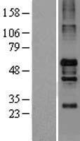 NOS1AP / CAPON Protein - Western validation with an anti-DDK antibody * L: Control HEK293 lysate R: Over-expression lysate