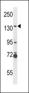 NOS2 / iNOS Antibody - NOS2A Antibody western blot of NCI-H292 cell line lysates (35 ug/lane). The NOS2A antibody detected the NOS2A protein (arrow).
