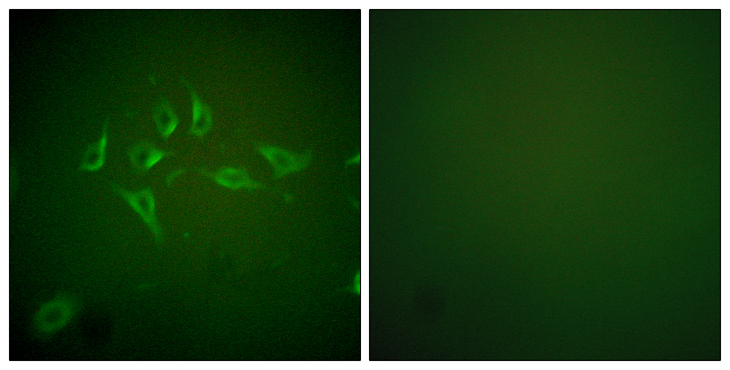 NOS2 / iNOS Antibody - Immunofluorescence analysis of HepG2 cells, using iNOS Antibody. The picture on the right is blocked with the synthesized peptide.