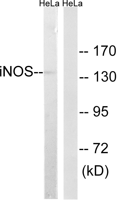 NOS2 / iNOS Antibody - Western blot analysis of lysates from HeLa cells, using iNOS Antibody. The lane on the right is blocked with the synthesized peptide.