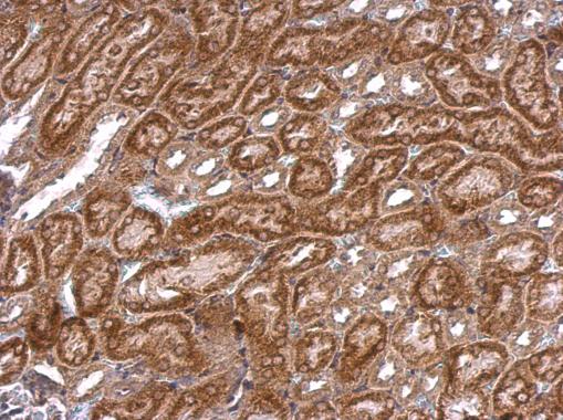 NOS2 / iNOS Antibody - Anti-iNOS antibody [N1N2-2], N-term used in IHC (Formalin-fixed paraffin-embedded sections).